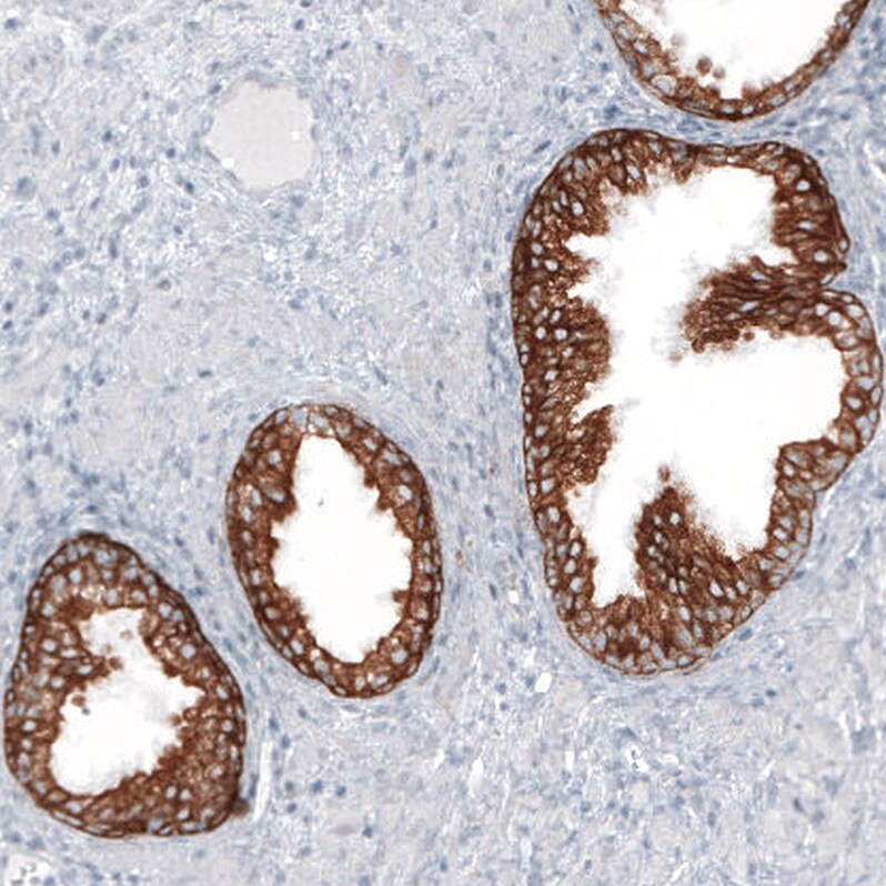 Cytokeratin 7 Antibody (CL8723) - Azide and BSA Free Immunohistochemistry-Paraffin: Cytokeratin 7 Antibody [NBP3-44035]