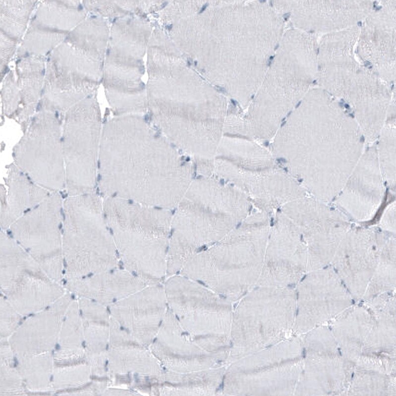 Cytokeratin 7 Antibody (CL8725) - Azide and BSA Free Immunohistochemistry-Paraffin: Cytokeratin 7 Antibody [NBP3-44036]