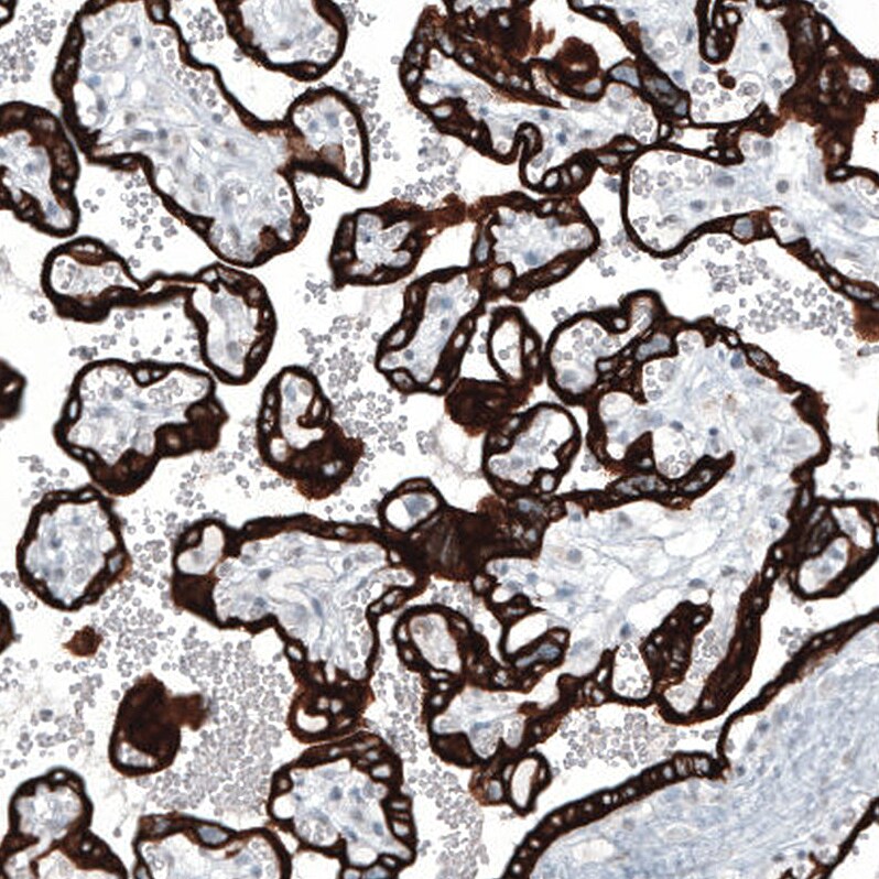 Cytokeratin 7 Antibody (CL8725) - Azide and BSA Free Immunohistochemistry-Paraffin: Cytokeratin 7 Antibody [NBP3-44036]