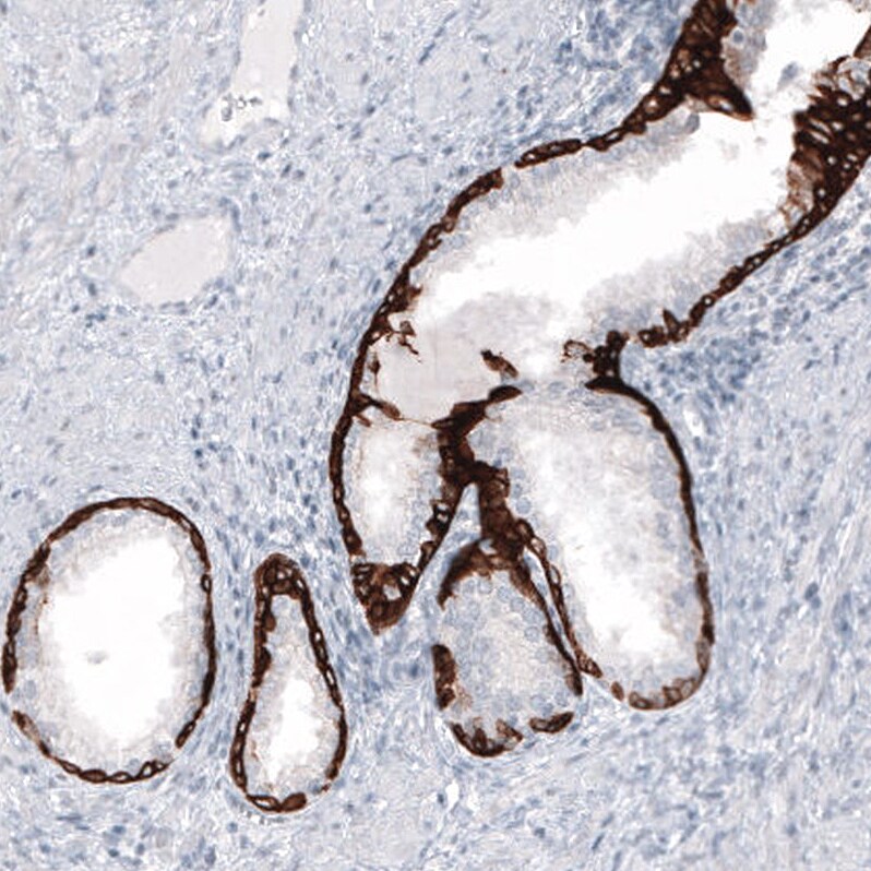 Cytokeratin 7 Antibody (CL8725) - Azide and BSA Free Immunohistochemistry-Paraffin: Cytokeratin 7 Antibody [NBP3-44036]