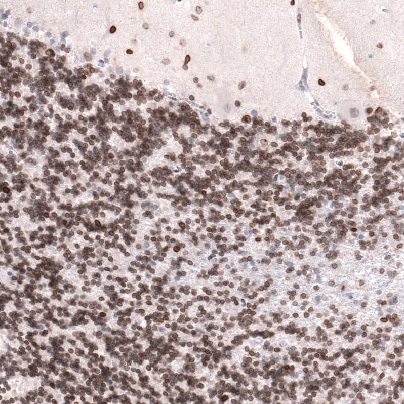 Lamin B1 Antibody (CL3929) - Azide and BSA Free Immunohistochemistry-Paraffin: Lamin B1 Antibody [NBP3-44038]