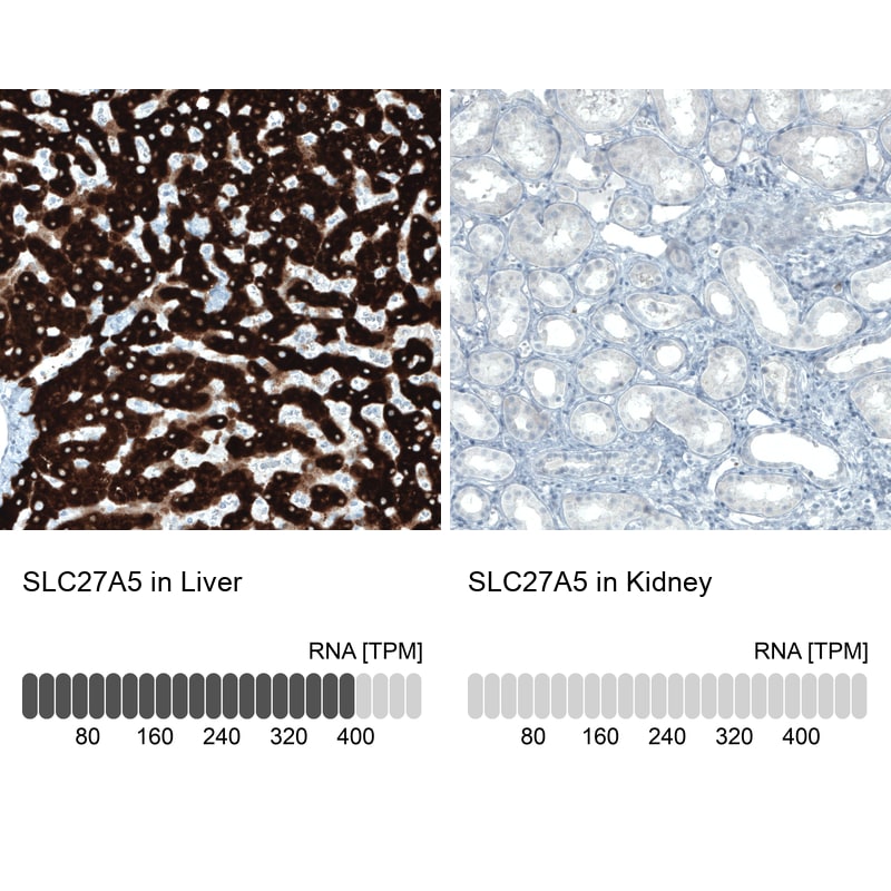 FATP5/SLC27A5 Antibody (CL0215) - Azide and BSA Free Immunohistochemistry-Paraffin: FATP5/SLC27A5 Antibody [NBP3-44039]