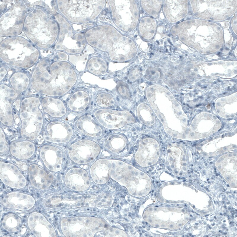 FATP5/SLC27A5 Antibody (CL0215) - Azide and BSA Free Immunohistochemistry-Paraffin: FATP5/SLC27A5 Antibody [NBP3-44039]