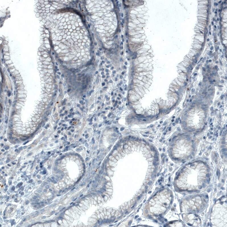 FATP5/SLC27A5 Antibody (CL0215) - Azide and BSA Free Immunohistochemistry-Paraffin: FATP5/SLC27A5 Antibody [NBP3-44039]
