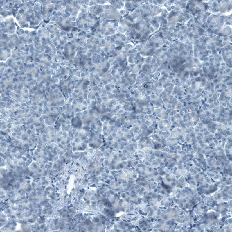 FATP5/SLC27A5 Antibody (CL0215) - Azide and BSA Free Immunohistochemistry-Paraffin: FATP5/SLC27A5 Antibody [NBP3-44039]
