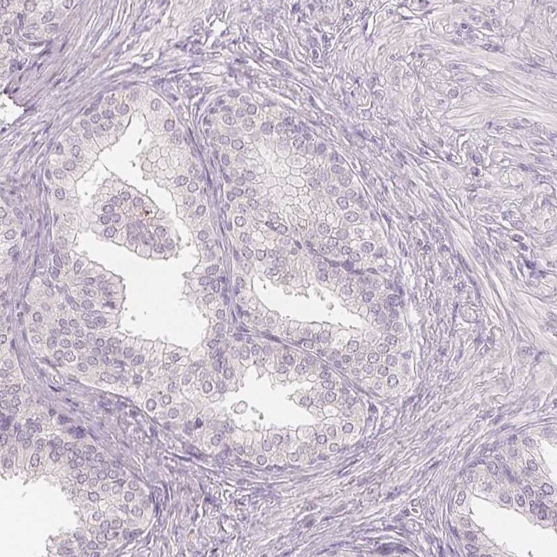 FATP5/SLC27A5 Antibody (CL0216) - Azide and BSA Free Immunohistochemistry-Paraffin: FATP5/SLC27A5 Antibody [NBP3-44040]