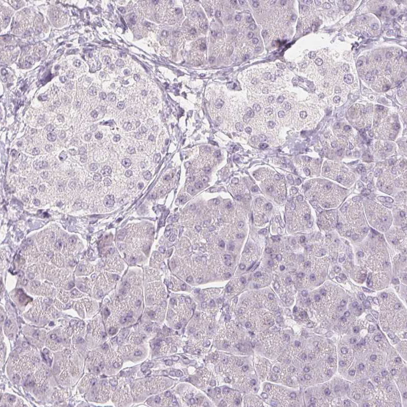 FATP5/SLC27A5 Antibody (CL0216) - Azide and BSA Free Immunohistochemistry-Paraffin: FATP5/SLC27A5 Antibody [NBP3-44040]