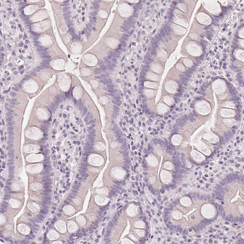 FATP5/SLC27A5 Antibody (CL0216) - Azide and BSA Free Immunohistochemistry-Paraffin: FATP5/SLC27A5 Antibody [NBP3-44040]