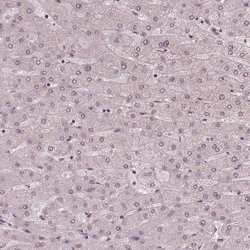 WHSC1 Antibody (CL1057) - Azide and BSA Free Immunohistochemistry-Paraffin: WHSC1 Antibody [NBP3-44041]