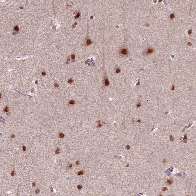 WHSC1 Antibody (CL1057) - Azide and BSA Free Immunohistochemistry-Paraffin: WHSC1 Antibody [NBP3-44041]