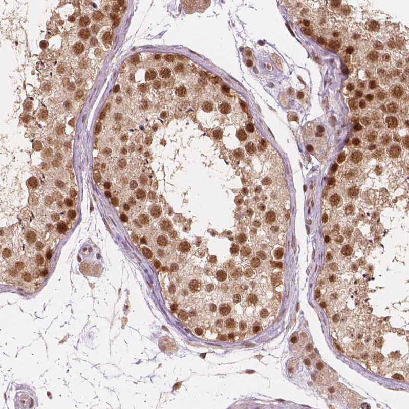WHSC1 Antibody (CL1057) - Azide and BSA Free Immunohistochemistry-Paraffin: WHSC1 Antibody [NBP3-44041]