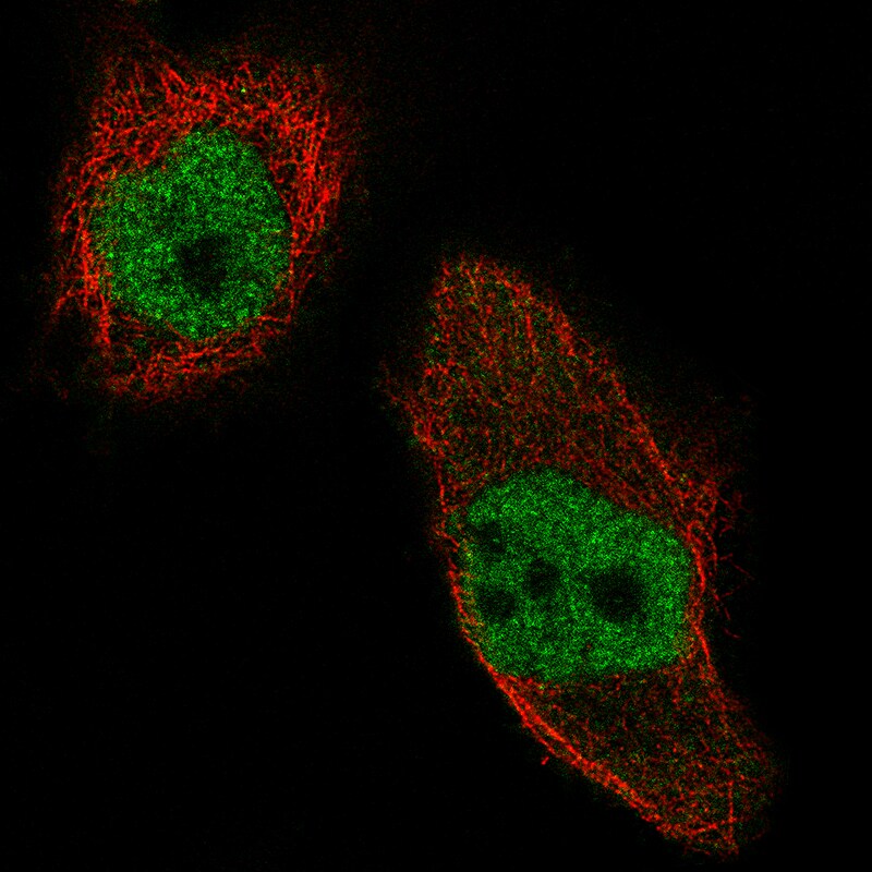 WHSC1 Antibody (CL1057) - Azide and BSA Free Immunocytochemistry/ Immunofluorescence: WHSC1 Antibody [NBP3-44041]