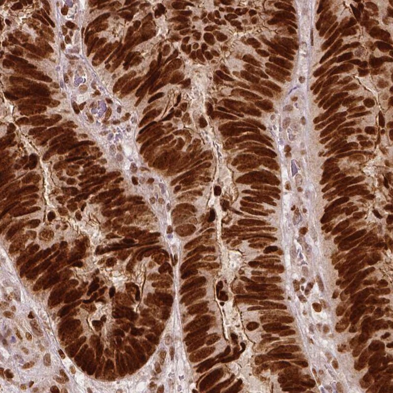 WHSC1 Antibody (CL1063) - Azide and BSA Free Immunohistochemistry-Paraffin: WHSC1 Antibody [NBP3-44042]