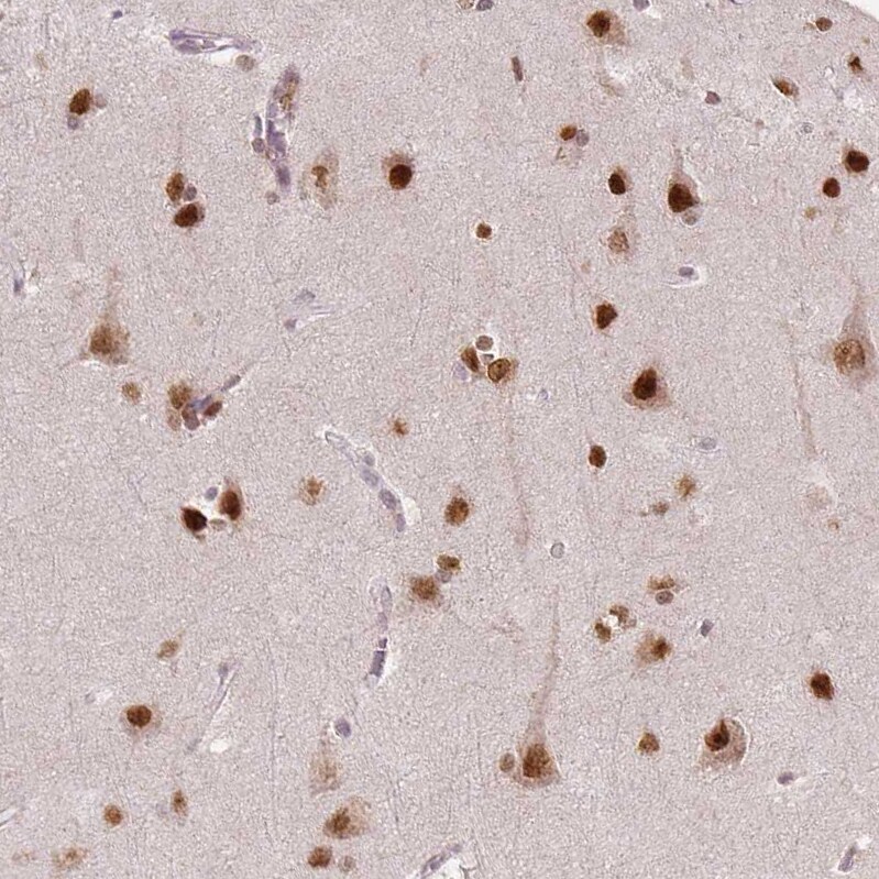 WHSC1 Antibody (CL1063) - Azide and BSA Free Immunohistochemistry-Paraffin: WHSC1 Antibody [NBP3-44042]