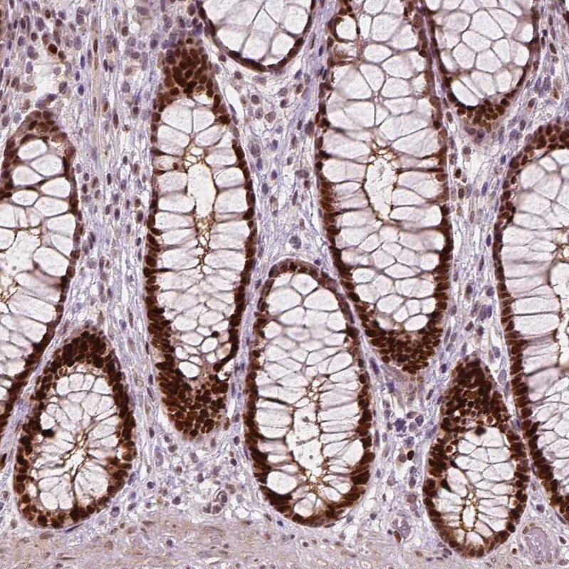 WHSC1 Antibody (CL1063) - Azide and BSA Free Immunohistochemistry-Paraffin: WHSC1 Antibody [NBP3-44042]