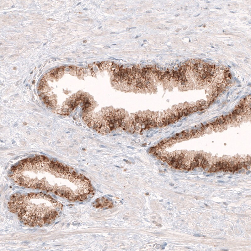 Granulin Antibody (CL5692) - Azide and BSA Free Immunohistochemistry-Paraffin: Granulin Antibody [NBP3-44043]