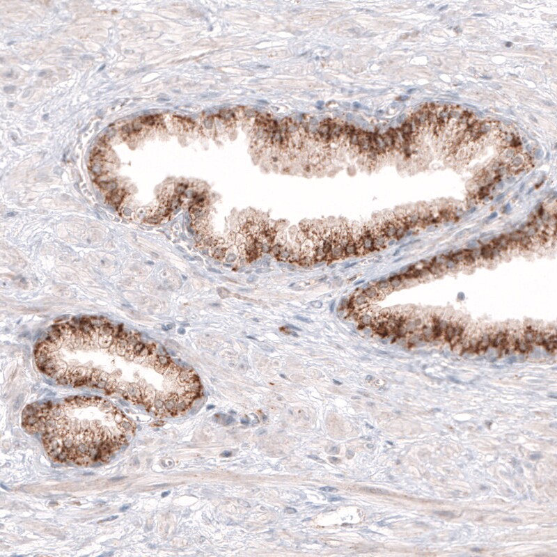 Granulin Antibody (CL5695) - Azide and BSA Free Immunohistochemistry-Paraffin: Granulin Antibody [NBP3-44044]