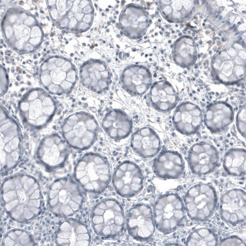 FRMD5 Antibody (CL9503) - Azide and BSA Free Immunohistochemistry-Paraffin: FRMD5 Antibody [NBP3-44045]