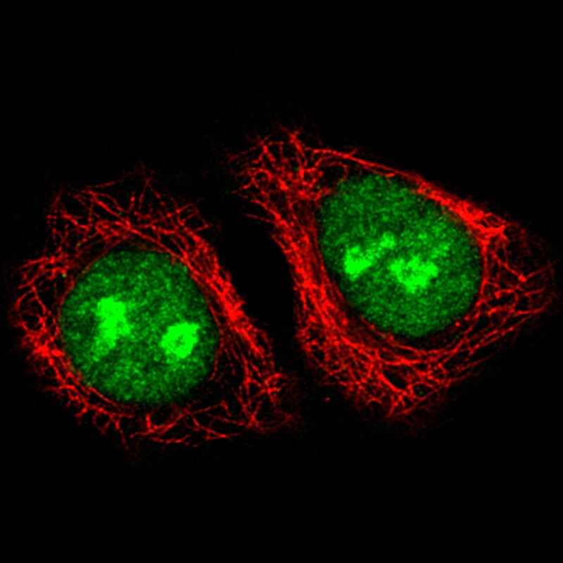 ADAR Antibody (CL0176) - Azide and BSA Free Immunocytochemistry/ Immunofluorescence: ADAR Antibody [NBP3-44046]