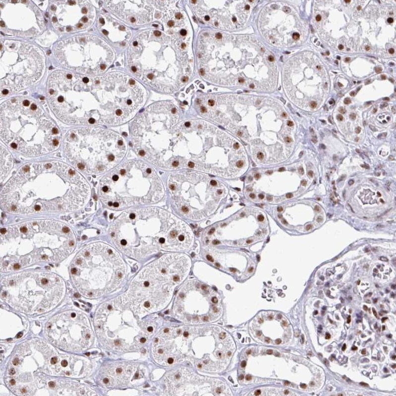 ADAR Antibody (CL0176) - Azide and BSA Free Immunohistochemistry-Paraffin: ADAR Antibody [NBP3-44046]