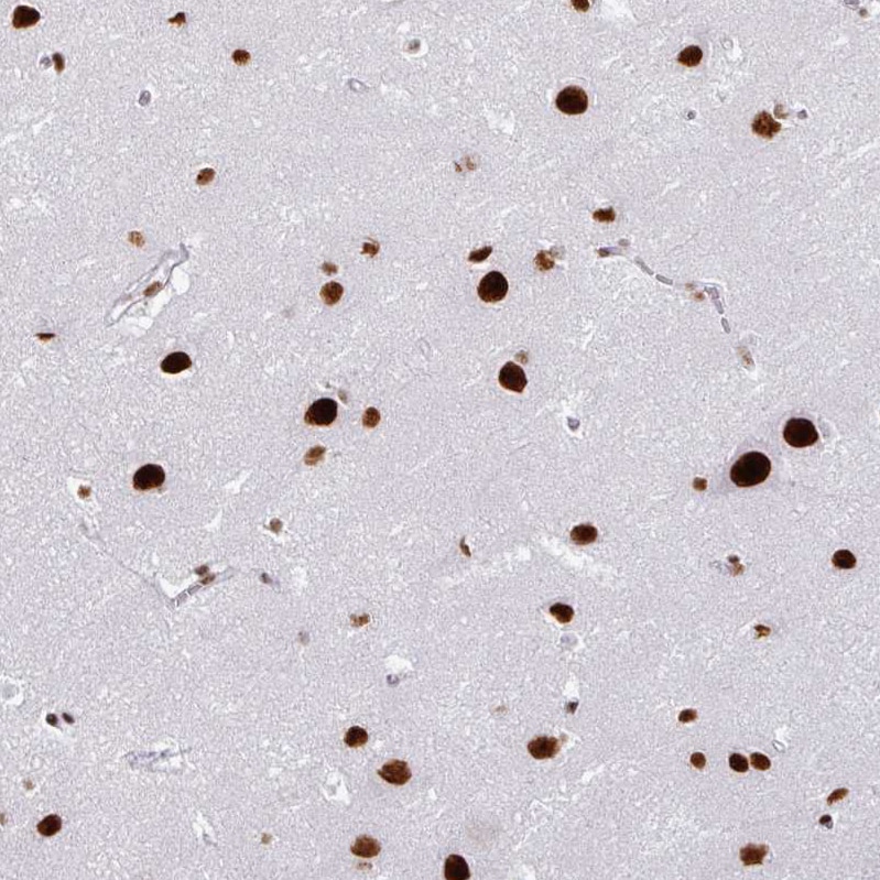 ADAR Antibody (CL0176) - Azide and BSA Free Immunohistochemistry-Paraffin: ADAR Antibody [NBP3-44046]