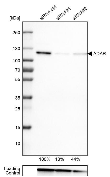 ADAR Antibody (CL0176) - Azide and BSA Free Western Blot: ADAR Antibody [NBP3-44046]