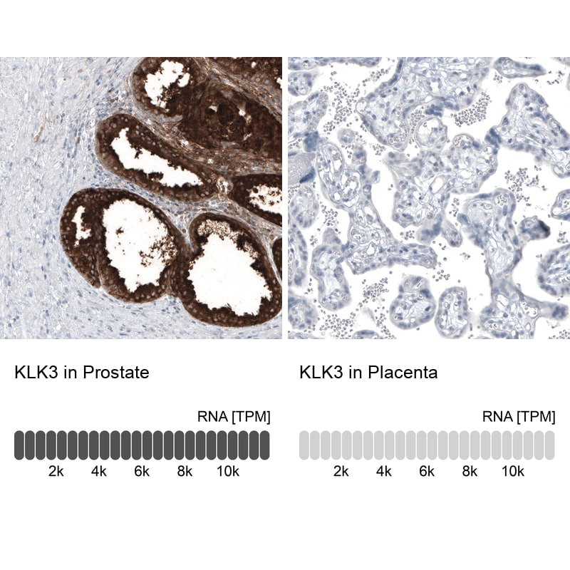 Kallikrein 3/PSA Antibody (CL9414) - Azide and BSA Free Immunohistochemistry-Paraffin: Kallikrein 3/PSA Antibody [NBP3-44047]