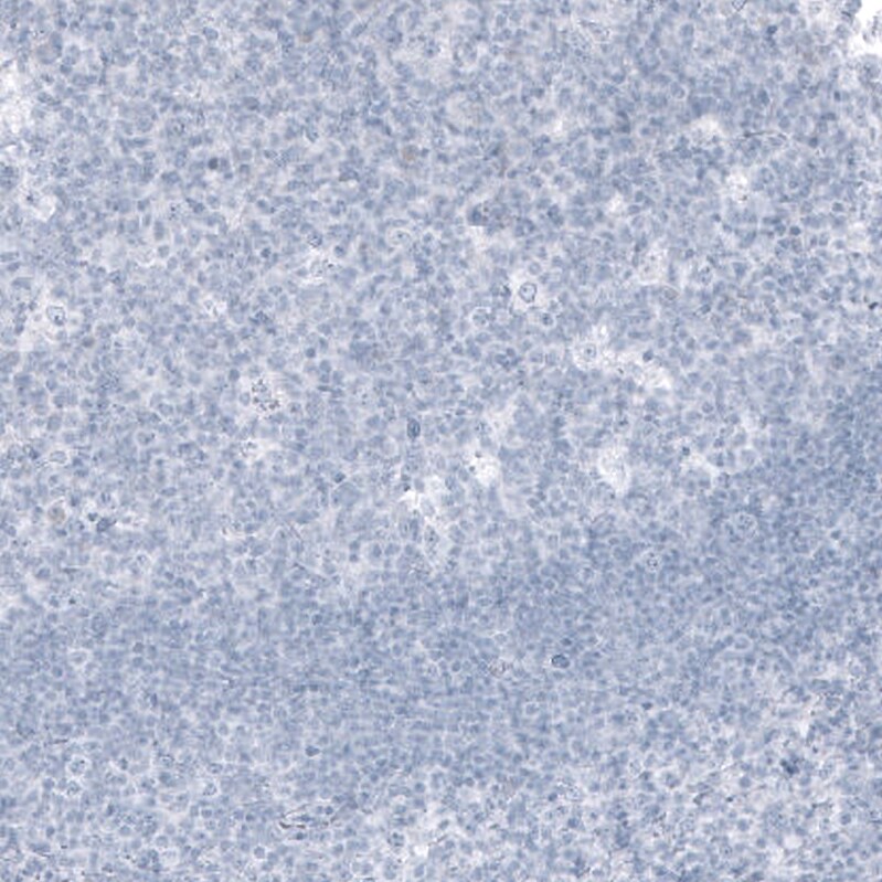 Kallikrein 3/PSA Antibody (CL9414) - Azide and BSA Free Immunohistochemistry-Paraffin: Kallikrein 3/PSA Antibody [NBP3-44047]