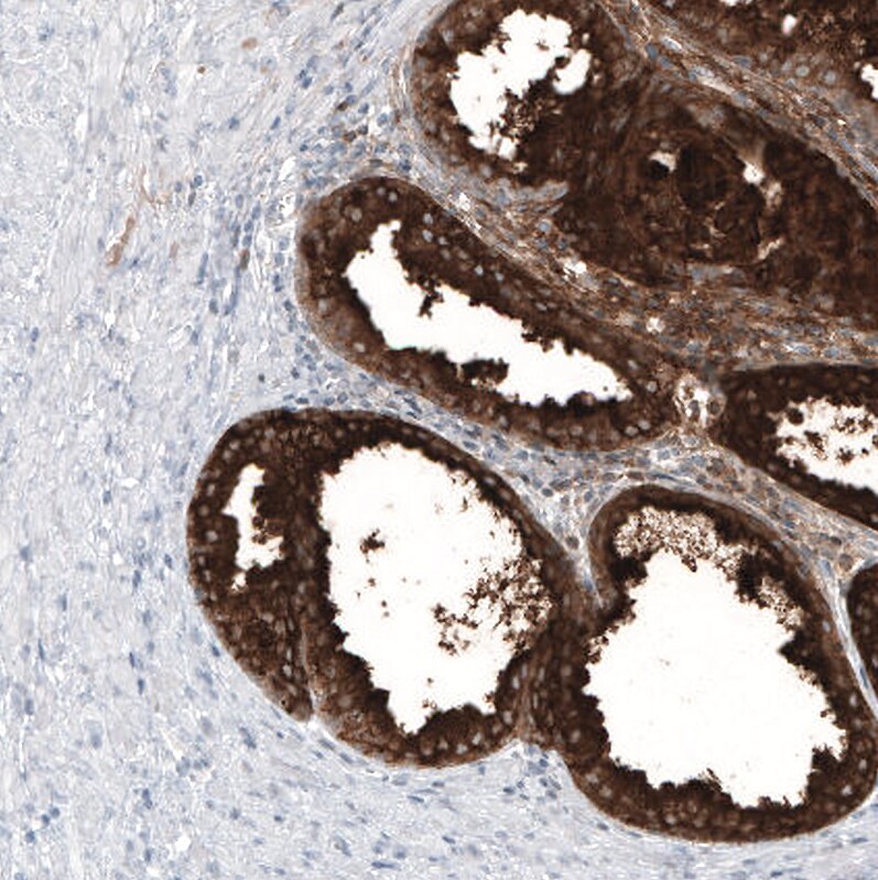 Kallikrein 3/PSA Antibody (CL9414) - Azide and BSA Free Immunohistochemistry-Paraffin: Kallikrein 3/PSA Antibody [NBP3-44047]