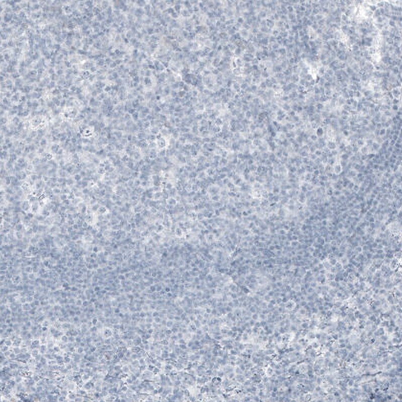 Kallikrein 3/PSA Antibody (CL9422) - Azide and BSA Free Immunohistochemistry-Paraffin: Kallikrein 3/PSA Antibody [NBP3-44048]