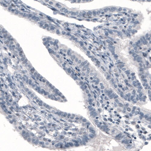 PGM1 Antibody (CL3299) - Azide and BSA Free Immunohistochemistry-Paraffin: PGM1 Antibody [NBP3-44049]