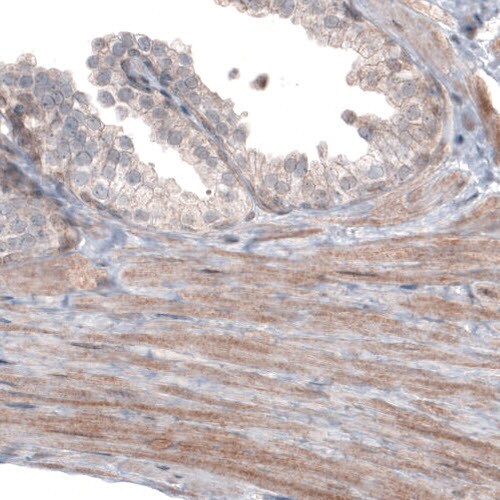 PGM1 Antibody (CL3299) - Azide and BSA Free Immunohistochemistry-Paraffin: PGM1 Antibody [NBP3-44049]