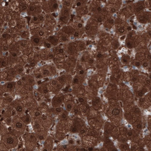 PGM1 Antibody (CL3299) - Azide and BSA Free Immunohistochemistry-Paraffin: PGM1 Antibody [NBP3-44049]