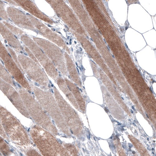 PGM1 Antibody (CL3299) - Azide and BSA Free Immunohistochemistry-Paraffin: PGM1 Antibody [NBP3-44049]