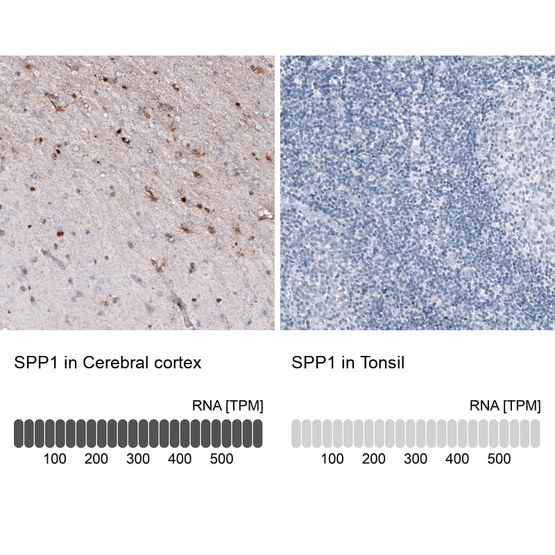 Osteopontin/OPN Antibody (CL10686) - Azide and BSA Free Immunohistochemistry-Paraffin: Osteopontin/OPN Antibody [NBP3-44052]