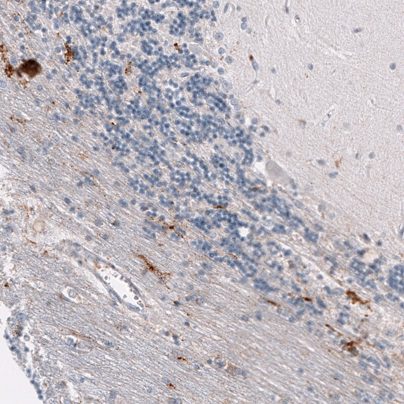 Osteopontin/OPN Antibody (CL10686) - Azide and BSA Free Immunohistochemistry-Paraffin: Osteopontin/OPN Antibody [NBP3-44052]