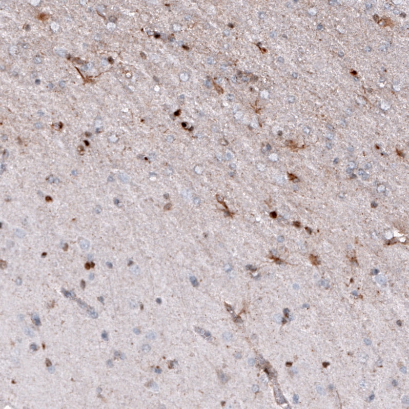 Osteopontin/OPN Antibody (CL10686) - Azide and BSA Free Immunohistochemistry-Paraffin: Osteopontin/OPN Antibody [NBP3-44052]