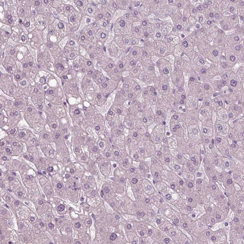 SOX9 Antibody (CL0639) - Azide and BSA Free Immunohistochemistry-Paraffin: SOX9 Antibody [NBP3-44053]