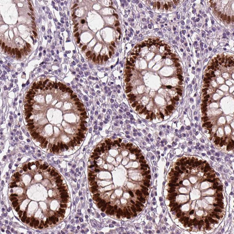 SOX9 Antibody (CL0639) - Azide and BSA Free Immunohistochemistry-Paraffin: SOX9 Antibody [NBP3-44053]