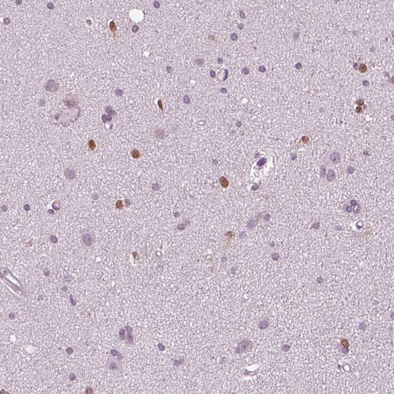 SOX9 Antibody (CL0639) - Azide and BSA Free Immunohistochemistry-Paraffin: SOX9 Antibody [NBP3-44053]