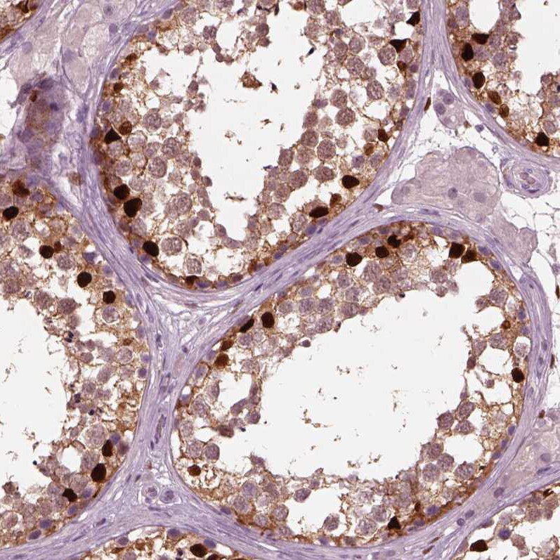 SOX9 Antibody (CL0639) - Azide and BSA Free Immunohistochemistry-Paraffin: SOX9 Antibody [NBP3-44053]