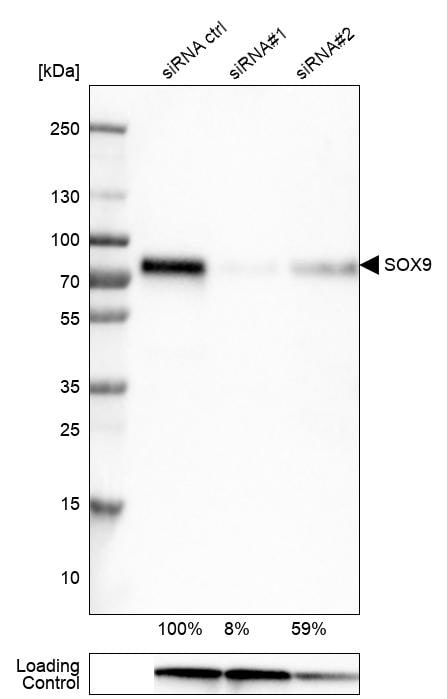 SOX9 Antibody (CL0639) - Azide and BSA Free Western Blot: SOX9 Antibody [NBP3-44053]