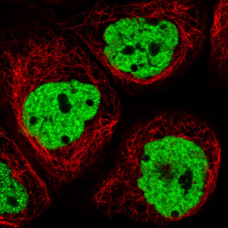 hnRNP C1 + C2 Antibody (CL2593) - Azide and BSA Free Immunocytochemistry/ Immunofluorescence: hnRNP C1 + C2 Antibody [NBP3-44054]
