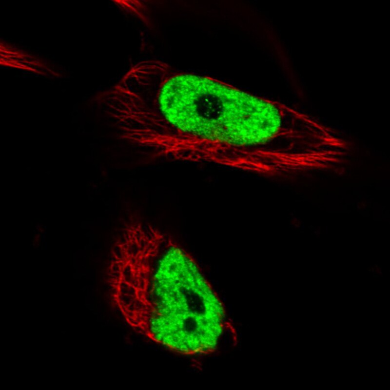 hnRNP C1 + C2 Antibody (CL2593) - Azide and BSA Free Immunocytochemistry/ Immunofluorescence: hnRNP C1 + C2 Antibody [NBP3-44054]