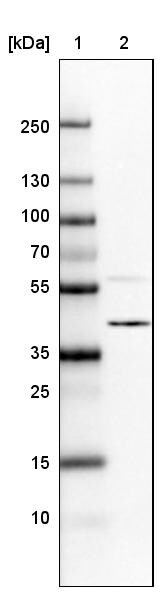 hnRNP C1 + C2 Antibody (CL2593) - Azide and BSA Free Western Blot: hnRNP C1 + C2 Antibody [NBP3-44054]