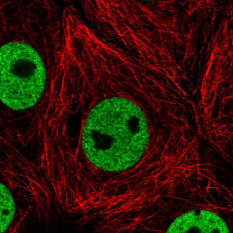hnRNP C1 + C2 Antibody (CL2593) - Azide and BSA Free Immunocytochemistry/ Immunofluorescence: hnRNP C1 + C2 Antibody [NBP3-44054]