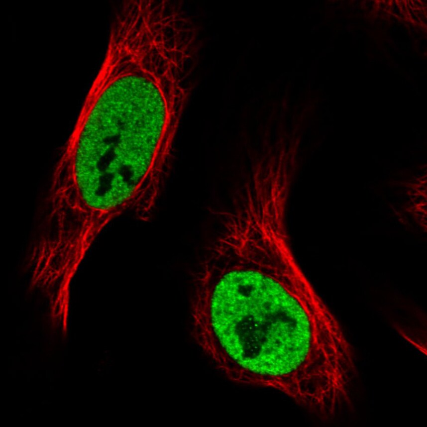 hnRNP C1 + C2 Antibody (CL2593) - Azide and BSA Free Immunocytochemistry/ Immunofluorescence: hnRNP C1 + C2 Antibody [NBP3-44054]