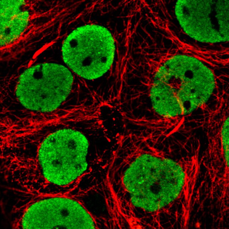 FUS Antibody (CL0190) - Azide and BSA Free Immunocytochemistry/ Immunofluorescence: FUS Antibody [NBP3-44055]