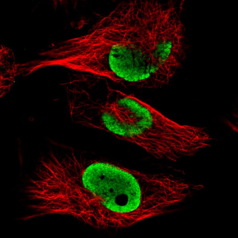 FUS Antibody (CL0190) - Azide and BSA Free Immunocytochemistry/ Immunofluorescence: FUS Antibody [NBP3-44055]