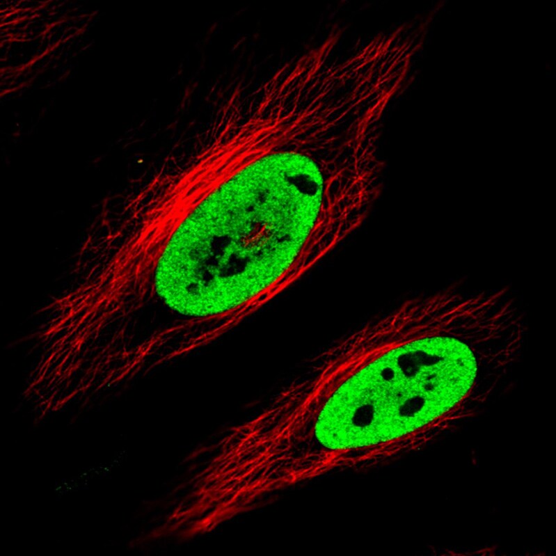 FUS Antibody (CL0190) - Azide and BSA Free Immunocytochemistry/ Immunofluorescence: FUS Antibody [NBP3-44055]